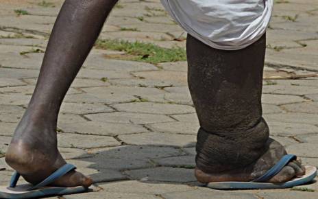 Civil Society Organizations (CSOs) have joined together to create Africa’s first civil society network for Neglected Tropical Diseases - the Civil Society Says No to NTDs Coalition.