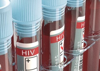 A team of scientists from Abbott have identified a new subtype of the human immunodeficiency virus (HIV), called HIV-1 Group M, subtype L.