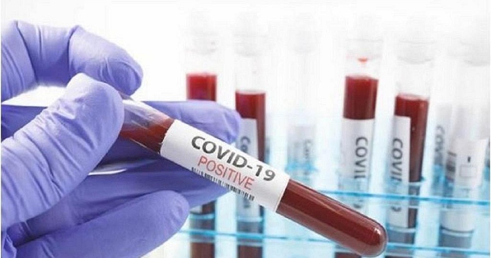 The number of COVID 19 cases in Uganda are now at 732 after 8 more new cases were discovered from 2,526 samples tested on 16 June 2020.