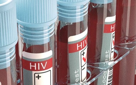 A team of scientists from Abbott have identified a new subtype of the human immunodeficiency virus (HIV), called HIV-1 Group M, subtype L.