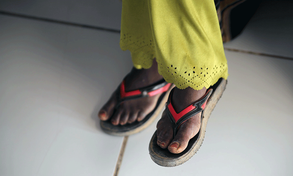 Discrimination of HIV/Aids Patients Remains High in Somalia